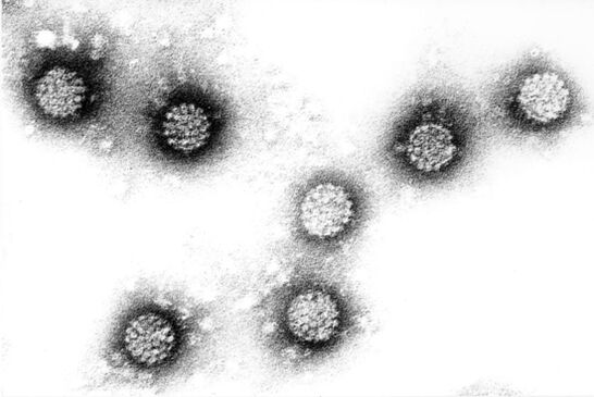 Mënsch Papilloma Virus