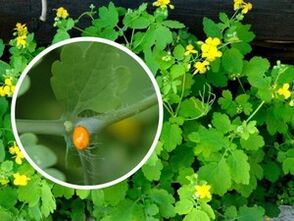 celandine Kraiderjus fir d'Behandlung vu plantarwarzen